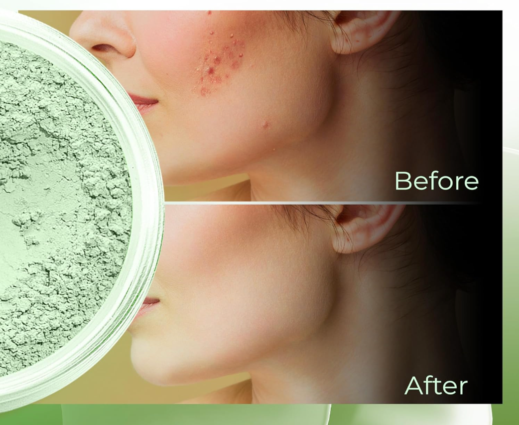 Green face concealer – emergency help in any situation