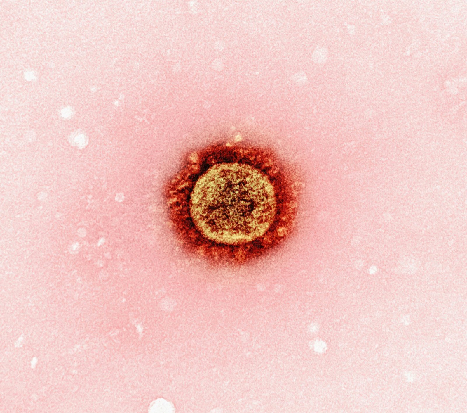 Manifestation of thrush and methods of its treatment