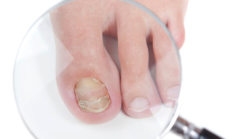 Why Is  the fungus dangerous